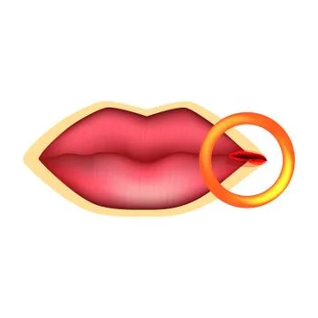 Cracks at the corners of the lips. Dry chapped lips. Wounds in the corners of Stock Illustration