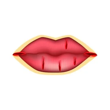 Cracks in the lips. Dry chapped lips. Wounds in the corners of the mouth Stock Illustration