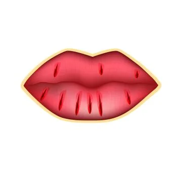 Cracks in the lips. Dry chapped lips. Infographics. Vector illustration on Stock Illustration