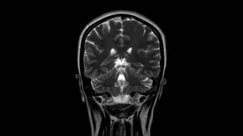 CRANEAL MRi Stock Footage 200960029