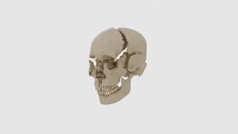 Cranial Bone Separation 3D Medical Animation Stock Footage 325019965