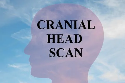 Cranial Head Scan concept Illustrazione stock