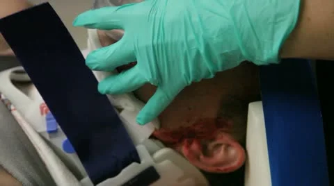 Crash Victim 20 Stock Footage 12334998