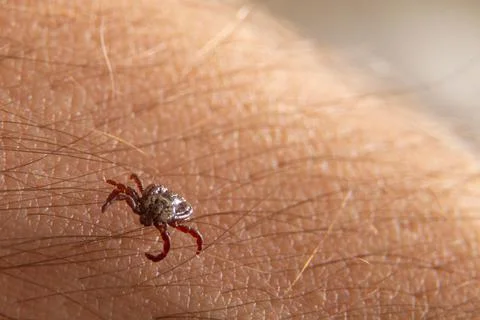 Crawling deer tick on the background of human hairy skin. Dangerous insect Stock Photos