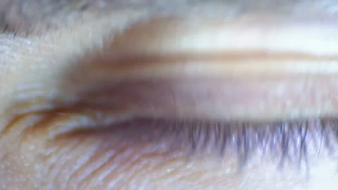 Crazy and Fear Look of Human Eye Stock Footage 103419961