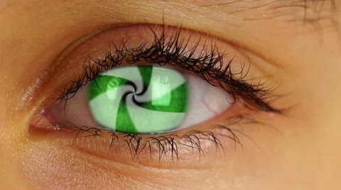 Crazy  Eye, close up Stock Footage 47840894