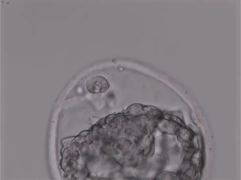 Creating a small crack in the female egg for the ivf embryo hatching process Stock Footage 256043046