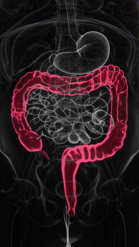 Crohn’s Disease Indication X-ray in Vertical Video | Crohn’s Disease X-ray in Stock Footage 301304960