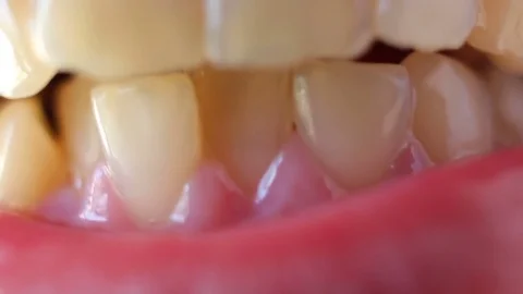Crooked teeth, macro shot Stock Footage 76714766