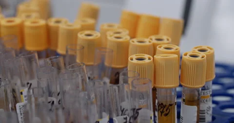 Crop view of worker in latex gloves taking one sample from laboratory test Stock Footage 147389654