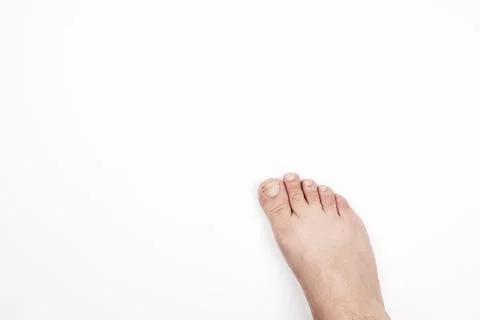 Cropped shot of a leg Stock Photos