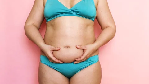 Cropped Image Overweight Fat Woman Stomach With Obesity, Excess