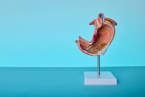 Cross section anatomical stomach model demonstrating stomach ulcer and pept.. Stock Photos