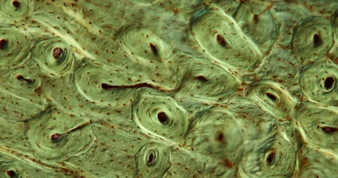 Cross-section of decalcified bone Stock Footage 136028873