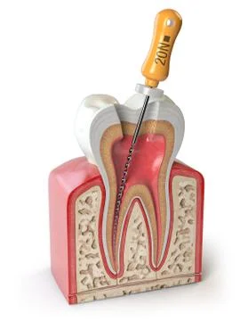 Cross section of Human tooth with endodontic file isolated on white. Stock Illustration
