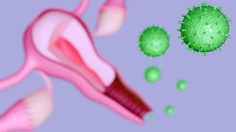 A cross-section of a human uterus and cervix surrounded by HPV Stock Illustration