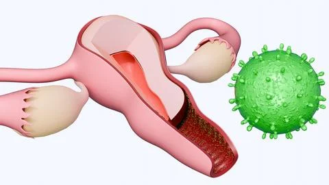 A cross-section of a human uterus and cervix surrounded by HPV Stock Illustration