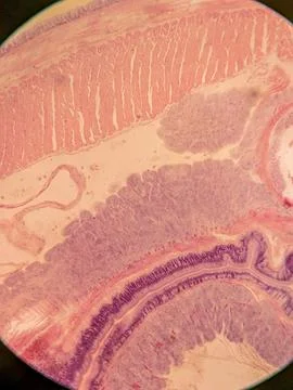 Cross-Section of a Nematode within an Earthworm 스톡 사진