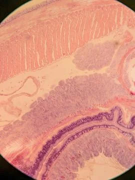 Cross-Section of a Nematode within an Earthworm Foto stock
