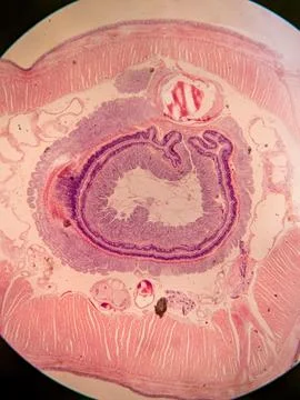 Cross-Section of a Nematode within an Earthworm Foto stock
