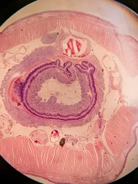 Cross-Section of a Nematode within an Earthworm 스톡 사진