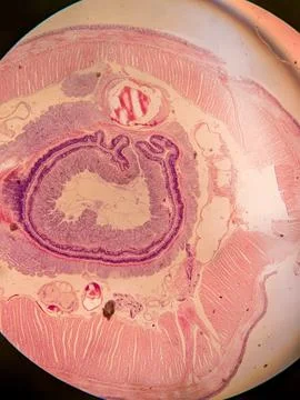 Cross-Section of a Nematode within an Earthworm Foto stock