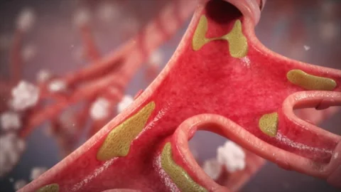 Cross-section of trachea during breathing: cold air triggers mucosal swelling Stock Footage 345199945