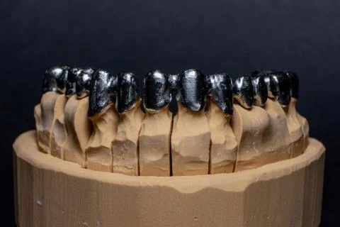Crown Framework and Tooth Mold Stock Photos