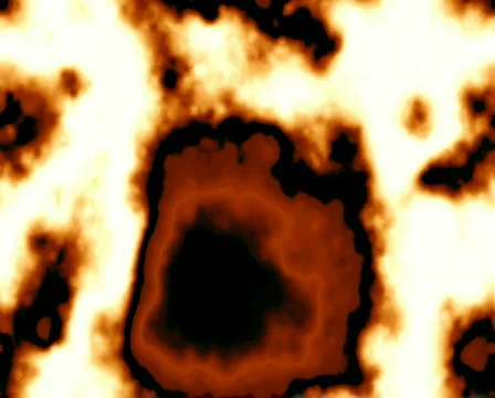 Crude Disease Video stock 101689