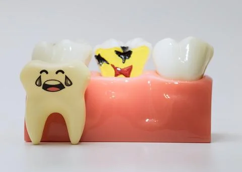 Crying tooth next to decayed model tooth Stock Photos
