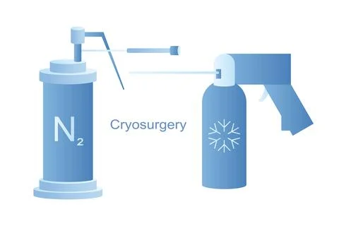 Cryo instruments for Cryosurgery vector line illustration. Liquid nitrogen Stock Illustration