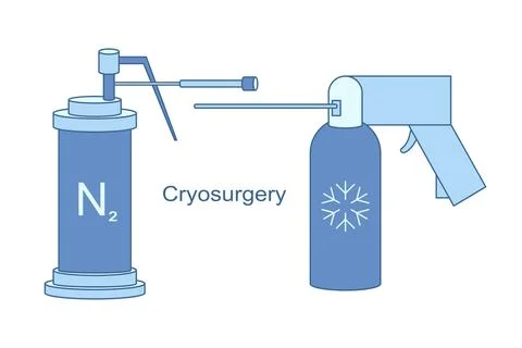 Cryo instruments for Cryosurgery vector line illustration. Liquid nitrogen Stock Illustration