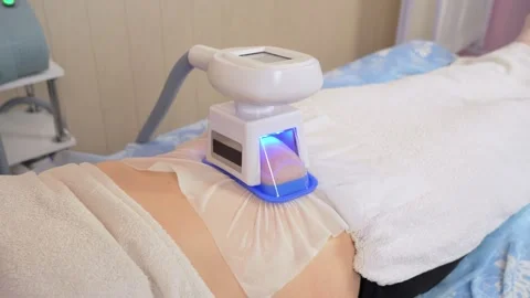Cryolipolysis of close up. Method of cold exposure to subcutaneous fat in order Stock Footage 301995821
