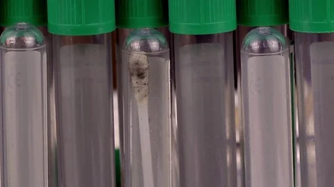 CSI test tubes close up Stock Footage 72634333