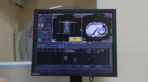 CT and MRI scan display Stock Footage 45458324