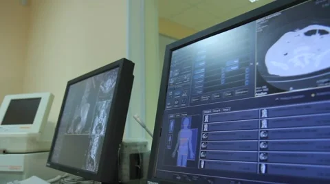 CT and MRI scan Stock Footage 39960296
