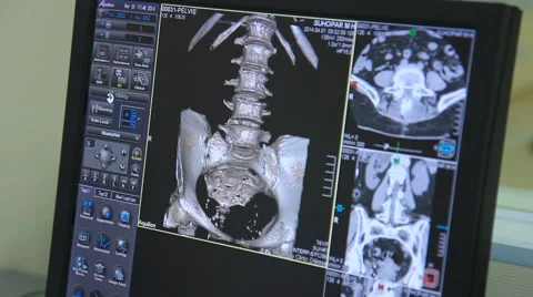 CT and MRI scanner Stock Footage 39960316
