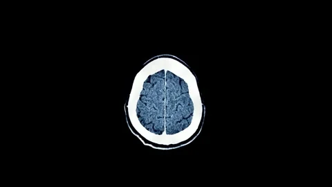 CT Brain scan image MRI human anatomy disease research healthy adult male Stock Footage 336561185