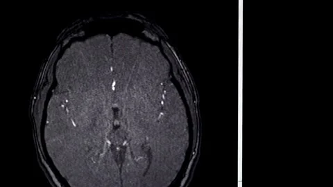 CT Brain scan image MRI human anatomy disease research healthy adult male Stock Footage 336561221