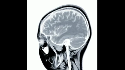 CT Brain scan image MRI human anatomy disease research healthy adult male 스톡 동영상 336569230