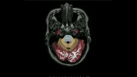 CT Brain scan image MRI human anatomy disease research healthy adult male Stock Footage 336569233