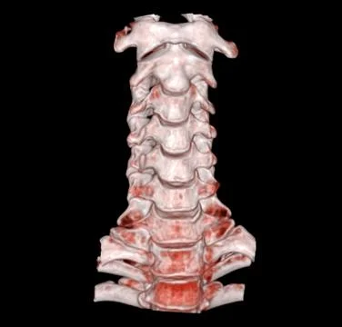 CT C-Spine or Cervical spine  3D Rendering image. Stock Illustration