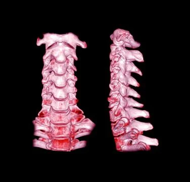 CT C-Spine or Cervical spine  3D Rendering image. Illustrazione stock