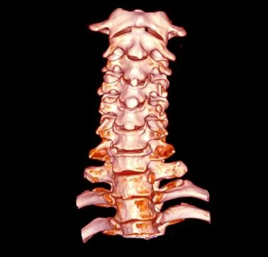 CT C-Spine or Cervical spine  3D Rendering image. 스톡 일러스트