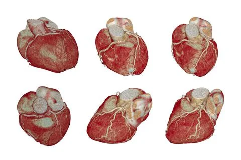 CT Cardiac 3D Clipping path. Stock Illustration