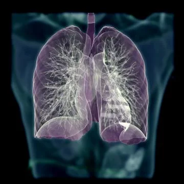 CT Chest or Lung 3D rendering image on blurred human body background for diag Illustrazione stock