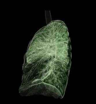 CT Chest or Lung 3D rendering image . Stock Illustration
