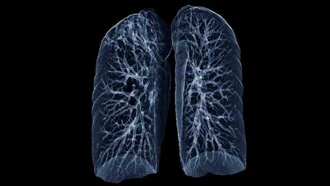 CT Chest or Lung 3d rendering image  showing Trachea and lung in respirator.. Stock Illustration