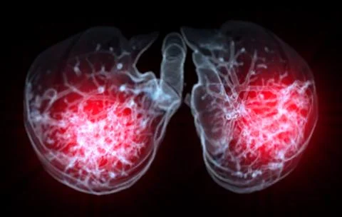 CT Chest or Lung 3d rendering image  showing Trachea and lung in respirator.. Illustrazione stock