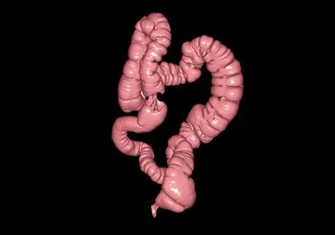 CT colonography  3D rendering. Stock Illustration